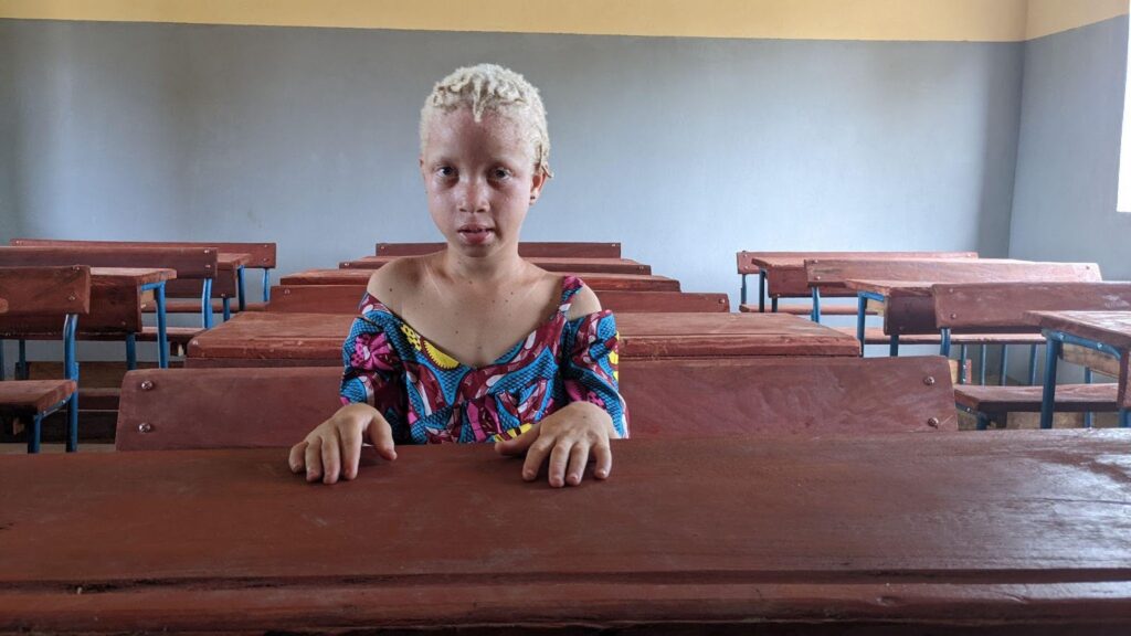 Maimouna’s own father kept her from attending school due to societal prejudice against albinism.